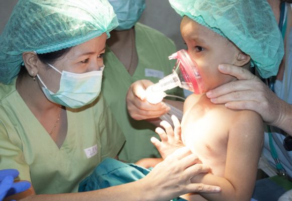 Everything you need to know about cleft lip and palate surgery