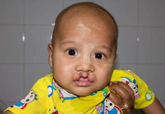 Sagaing Patients and their Families