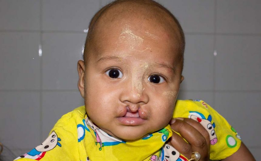 Sagaing Patients and their Families